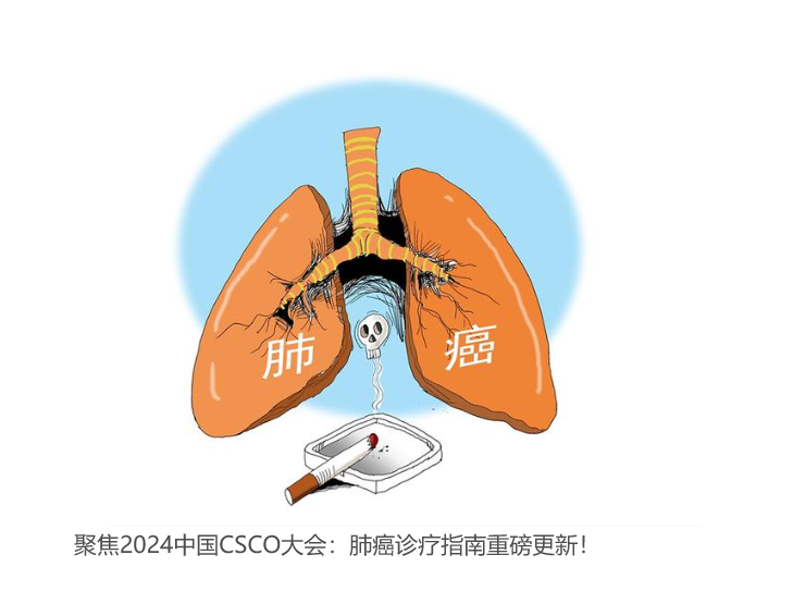聚焦2024中国CSCO大会：肺癌诊疗指南重磅更新！
